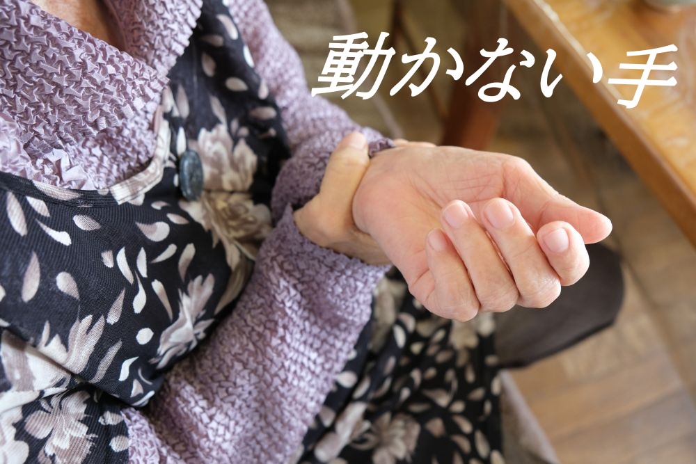 天満さんの手が不自由になった時のイメージ画